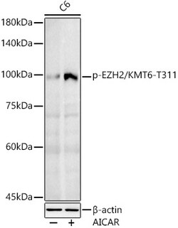 ABclonal Technology&nbsp;Phospho-EZH2/KMT6-T311 Rabbit pAb