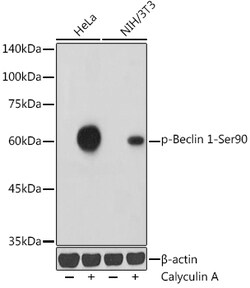 ABclonal Technology&nbsp;Phospho-Beclin 1-Ser90 Rabbit pAb