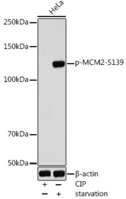 ABclonal Technology&nbsp;Phospho-MCM2-S139 Rabbit pAb