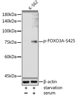 ABclonal Technology&nbsp;Phospho-FOXO3A-S425 Rabbit pAb