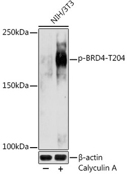 ABclonal Technology&nbsp;Phospho-BRD4-T204 Rabbit pAb
