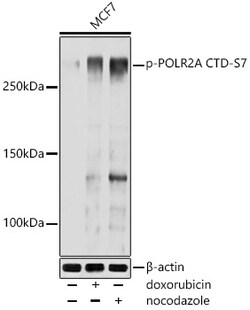 ABclonal Technology&nbsp;Phospho-POLR2A CTD-S7 Rabbit pAb