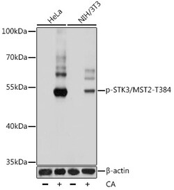 ABclonal Technology&nbsp;Phospho-STK3/MST2-T384 Rabbit pAb
