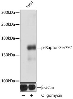 ABclonal Technology&nbsp;Phospho-Raptor-Ser792 Rabbit pAb