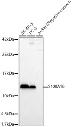 ABclonal Technology&nbsp;S100A16 Rabbit pAb
