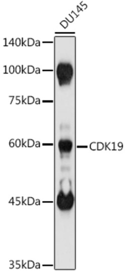 ABclonal Technology&nbsp;CDK19 Rabbit pAb