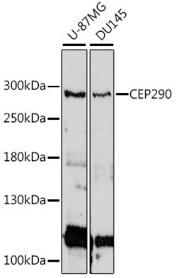 ABclonal Technology&nbsp;CEP290 Rabbit pAb
