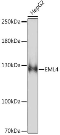 ABclonal Technology&nbsp;EML4 Rabbit pAb