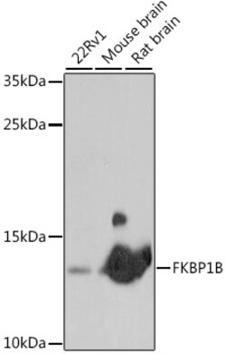 ABclonal Technology&nbsp;FKBP1B Rabbit pAb