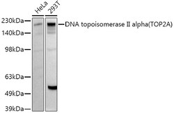 ABclonal Technology&nbsp;DNA topoisomerase II alpha (TOP2A) Rabbit pAb
