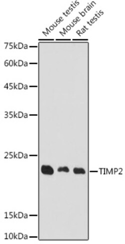 ABclonal Technology&nbsp;TIMP2 Rabbit pAb