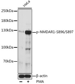 ABclonal Technology&nbsp;Phospho-NMDAR1-S896/S897 Rabbit pAb