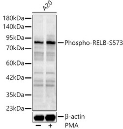 ABclonal Technology&nbsp;Phospho-RELB-S573 Rabbit pAb