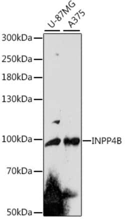 ABclonal Technology&nbsp;INPP4B Rabbit pAb
