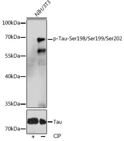 ABclonal Technology&nbsp;Phospho-Tau-Ser198/Ser199/Ser202 Rabbit pAb