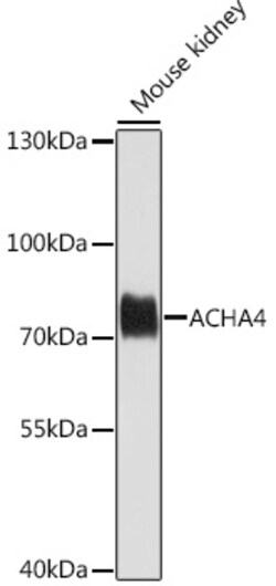 ABclonal Technology&nbsp;ACHA4 Rabbit pAb