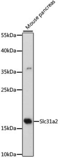ABclonal Technology&nbsp;Slc31a2 Rabbit pAb