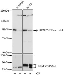 ABclonal Technology&nbsp;Phospho-CRMP2/DPYSL2-T514 Rabbit pAb