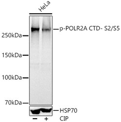 ABclonal Technology&nbsp;Phospho-POLR2A CTD- S2/S5 Rabbit pAb
