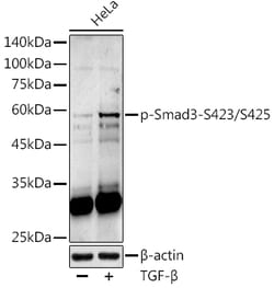 ABclonal Technology&nbsp;Phospho-Smad3-S423/S425 Rabbit pAb