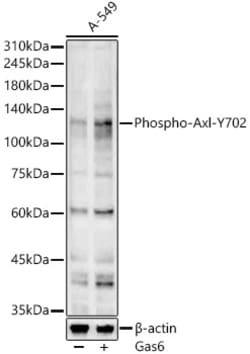 ABclonal Technology&nbsp;Phospho-Axl-Y702 Rabbit pAb