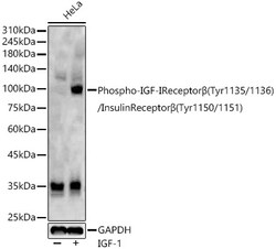 ABclonal Technology&nbsp;Phospho-IGF-IReceptorβ(Tyr1135/1136)/InsulinReceptorβ(Tyr1150/1151) Rabbit pAb