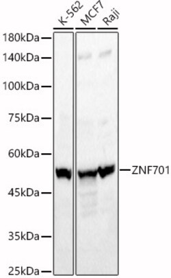 ABclonal Technology&nbsp;ZNF701 Rabbit pAb