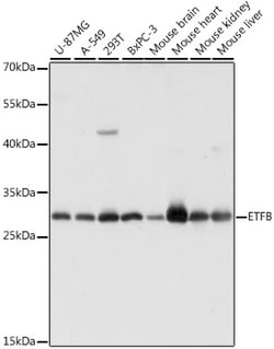 ABclonal Technology&nbsp;ETFB Rabbit pAb