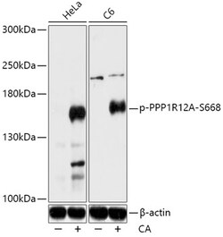 ABclonal Technology&nbsp;Phospho-PPP1R12A-S668 Rabbit pAb