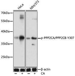 ABclonal Technology&nbsp;Phospho-PPP2CA/PPP2CB-Y307 Rabbit pAb