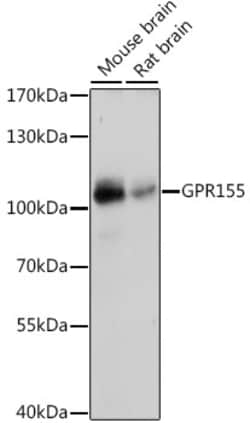 ABclonal Technology&nbsp;GPR155 Rabbit pAb