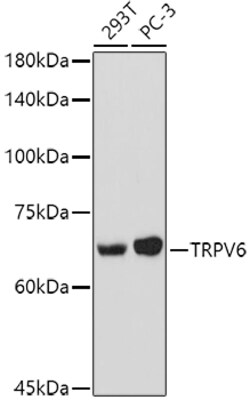 ABclonal Technology&nbsp;TRPV6 Rabbit pAb