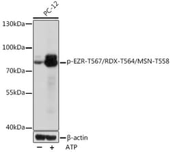 ABclonal Technology&nbsp;Phospho-EZR-T567/RDX-T564/MSN-T558 Rabbit pAb