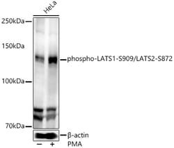 ABclonal Technology&nbsp;phospho-LATS1-S909/LATS2-S872 Rabbit pAb