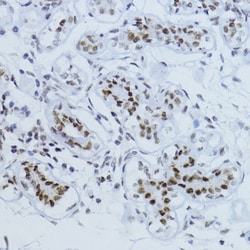 ABclonal Technology&nbsp;Phospho-Smad2-T220 Rabbit pAb