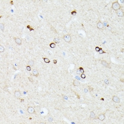 ABclonal Technology&nbsp;CCDC6 Rabbit pAb