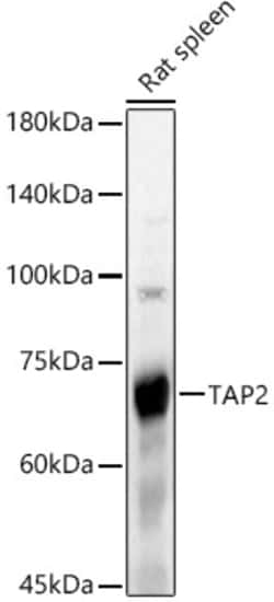 ABclonal Technology&nbsp;TAP2 Rabbit pAb