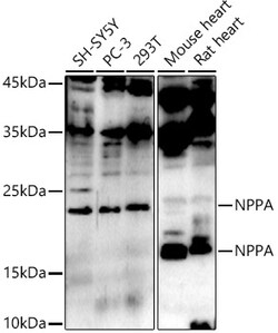 ABclonal Technology&nbsp;NPPA Rabbit pAb