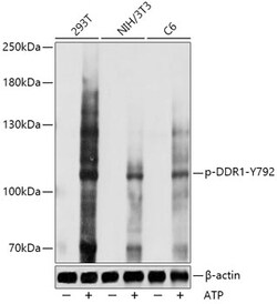 ABclonal Technology&nbsp;Phospho-DDR1-Y792 Rabbit pAb