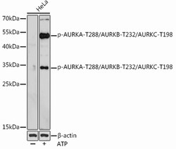ABclonal Technology&nbsp;Phospho-AURKA-T288/AURKB-T232/AURKC-T198 Rabbit pAb