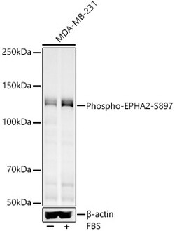 ABclonal Technology&nbsp;Phospho-EPHA2-S897 Rabbit pAb