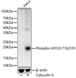 ABclonal Technology&nbsp;Phospho-MYL9-T18/S19 Rabbit pAb