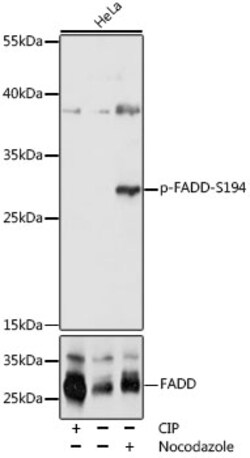 ABclonal Technology&nbsp;Phospho-FADD-S194 Rabbit pAb