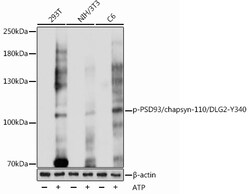 ABclonal Technology&nbsp;Phospho-PSD93/chapsyn-110/DLG2-Y340 Rabbit pAb