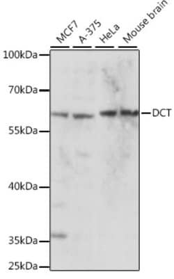 ABclonal Technology&nbsp;DCT Rabbit pAb