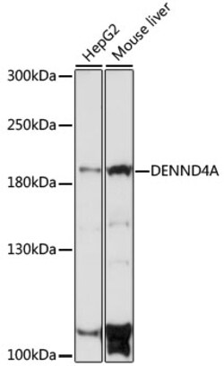 ABclonal Technology&nbsp;DENND4A Rabbit pAb