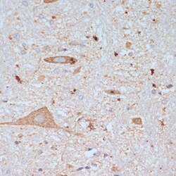 ABclonal Technology&nbsp;SLC18A3 Rabbit pAb