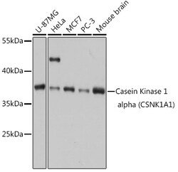 ABclonal Technology&nbsp;Casein Kinase 1 alpha (CSNK1A1) Rabbit pAb