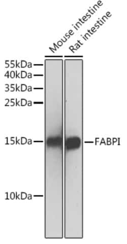 ABclonal Technology&nbsp;FABPI Rabbit pAb