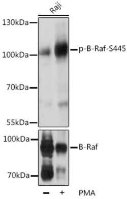 ABclonal Technology&nbsp;Phospho-B-Raf-S445 Rabbit pAb